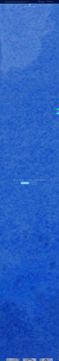 Blue Turtle Dental Is Now An Invisalign Gold Plus+ Dentist in ... Blue Turtle Dental Is Now An Invisalign Gold Plus+ Dentist in ...